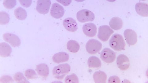 Immune Responses in Chronic Diseases May Be Driven by Tissue Stiffness