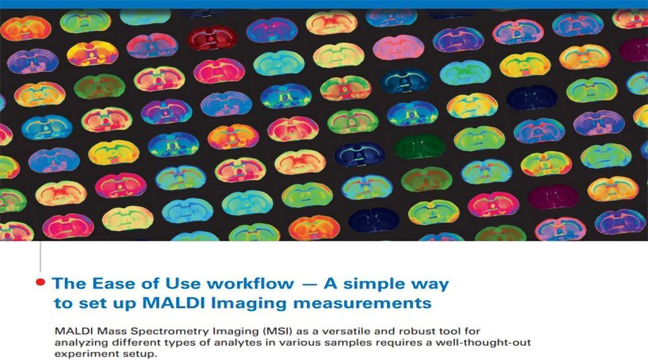 A Simple Way To Set Up MALDI Imaging Measurements