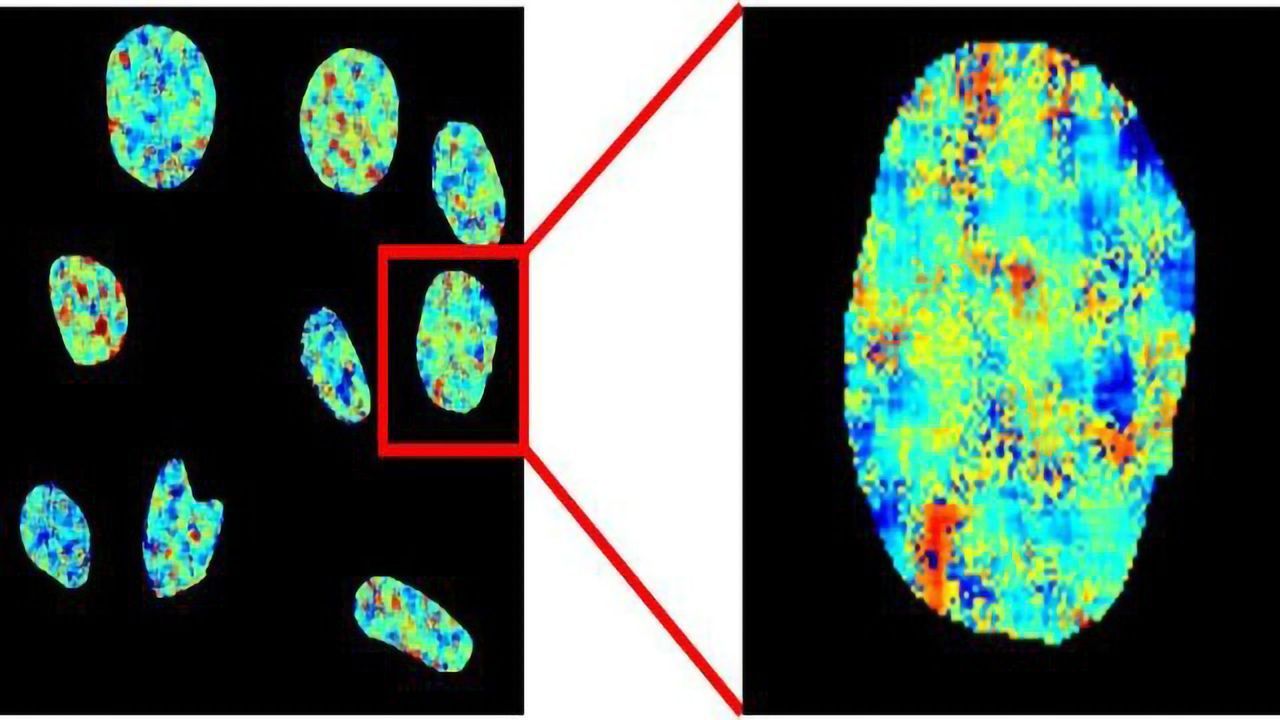 Quadruple-Helix DNA Found in Living Human Cells