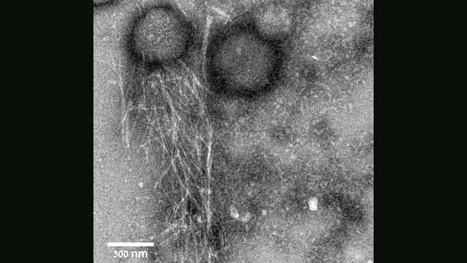 Exploiting the Antimicrobial Properties of Toadlet Peptide To Kill Bacteria content piece image