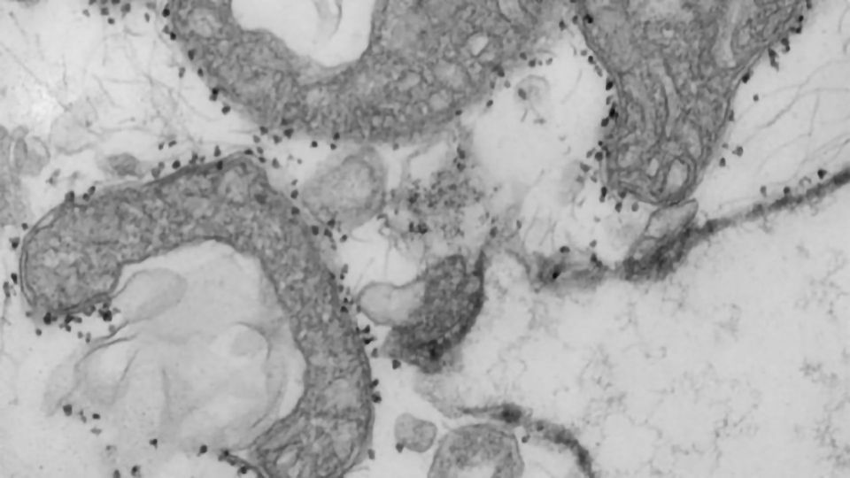 Rapid Blood Test Identifies COVID-19 Patients at High Risk of Severe Disease content piece image