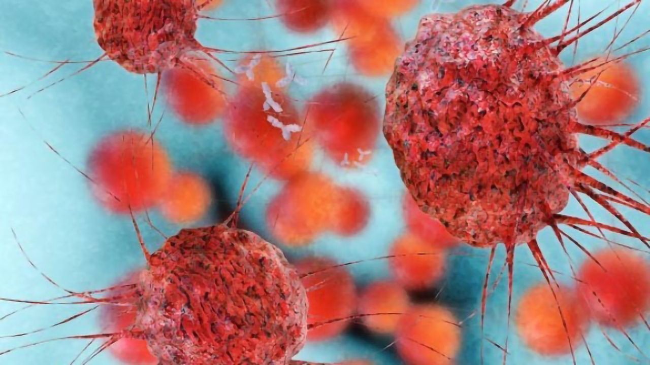 Computational Tool Differentiates Between Data From Cancer Cells and Normal Cells