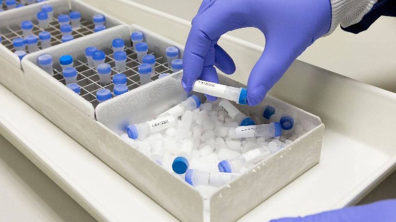 Pressing the Pause Button: How To Cryopreserve Cells Successfully