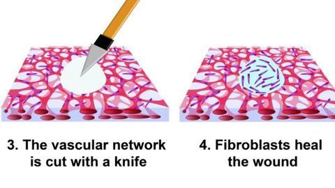 New Insights Into Wound Healing Process