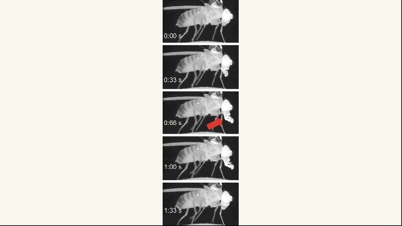 Deep Sleep Takes Out the Brain's Trash
