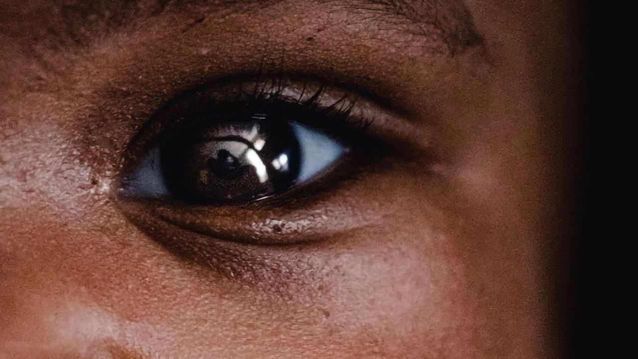 Eye Tests Predicted Parkinson's-Related Cognitive Decline 18 Months Ahead