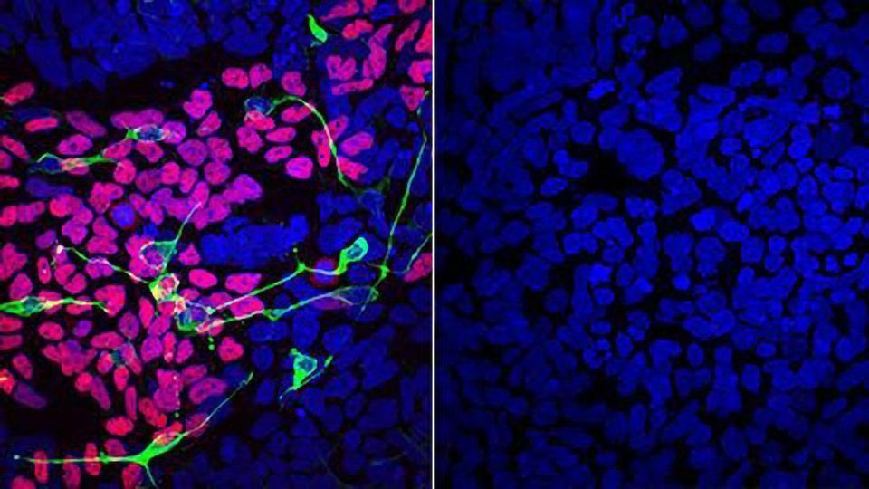 New Genetic Disorder Discovered That Affects Brain and Craniofacial Skeleton content piece image