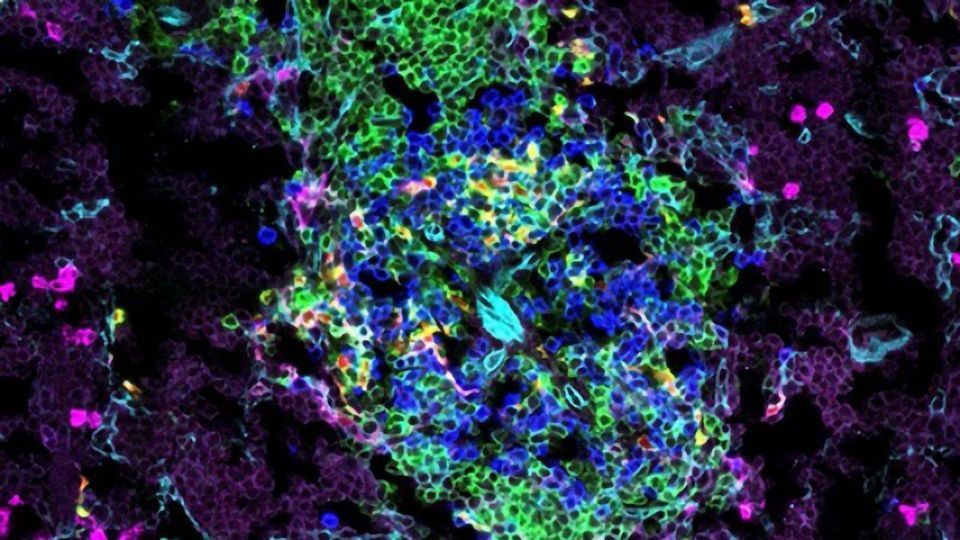 Infant Immune Cells Not Functionally Immature as Previously Thought content piece image