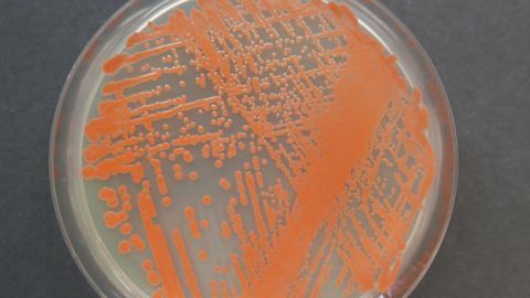 Red Yeast From Deep-Sea Sediment Shows Anticancer and Antibacterial Properties