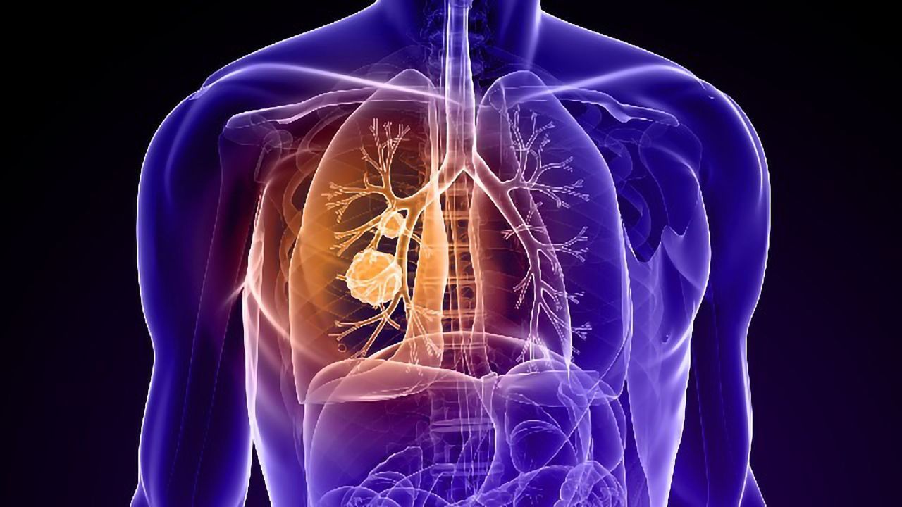 Team Investigates Potential Drug Therapy Combination for Lung Cancer