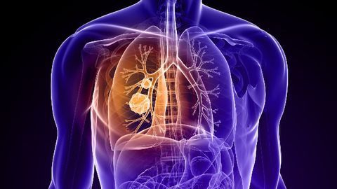 Team Investigates Potential Drug Therapy Combination for Lung Cancer