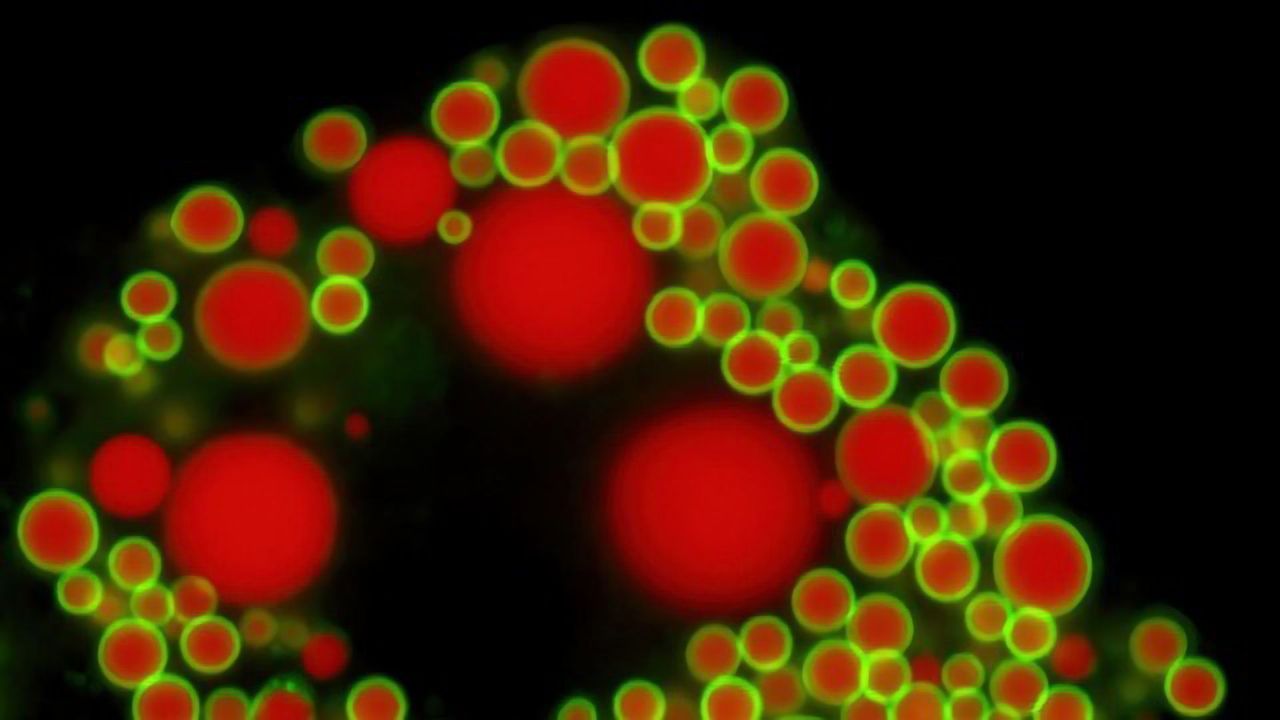 Coconut Oil and Rapeseed Oil Treated Differently by the Liver