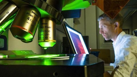 Mouse Study Links Depression, Inflammation and Microglia