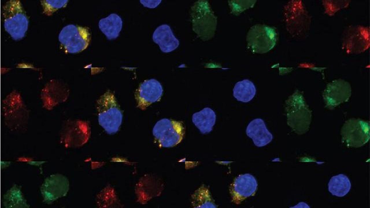 Antiviral Enzymes Convert Pre-Leukemia Stem Cells Into Leukemia
