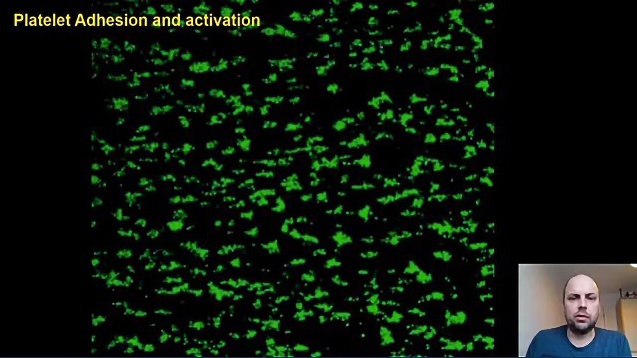Up Close and Personal With Platelets – Professor Nicholas Pugh