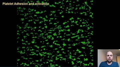 Up Close and Personal With Platelets – Professor Nicholas Pugh