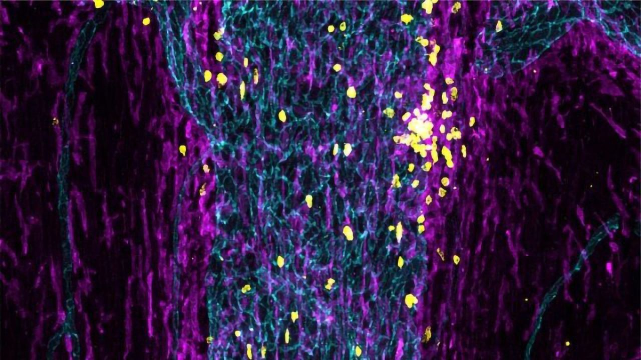 How the Immune System Keeps an Eye on the Brain