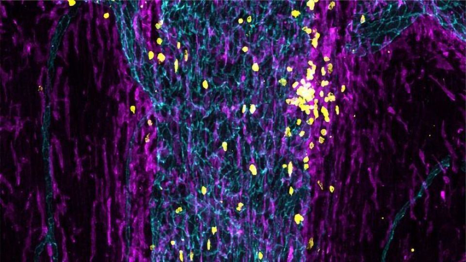 How the Immune System Keeps an Eye on the Brain content piece image