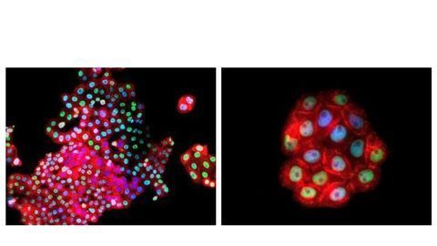 Patient-Derived Human Primary Cancer Cells