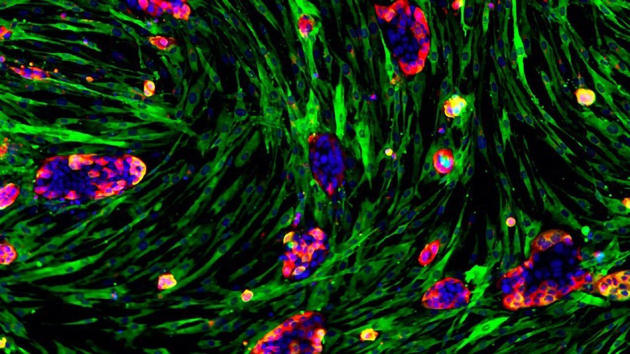 Leveraging AI To Identify and Target Novel Cell–Cell Interactions