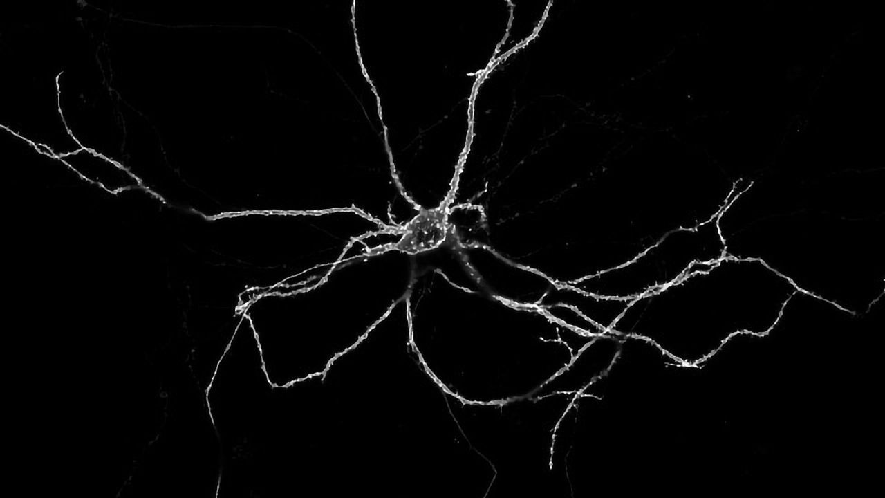 "String of Lights" Imaging Technique Tracks Neurons at Work