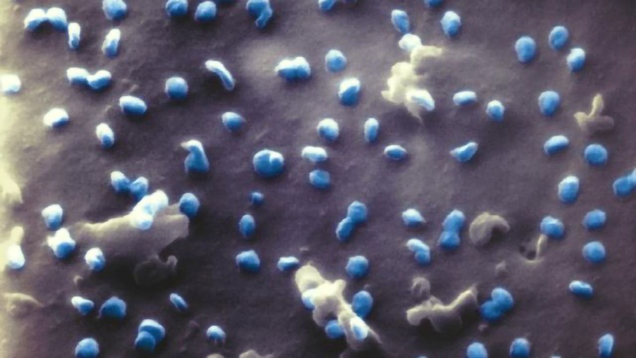 First Images of SARS-CoV-2 Under the Helium Ion Microscope