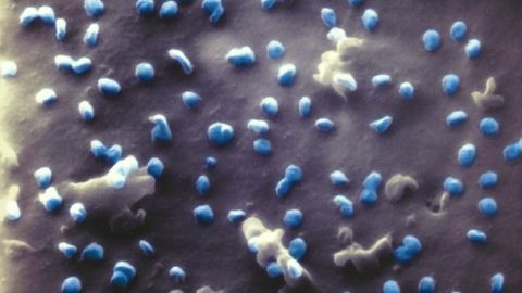 First Images of SARS-CoV-2 Under the Helium Ion Microscope
