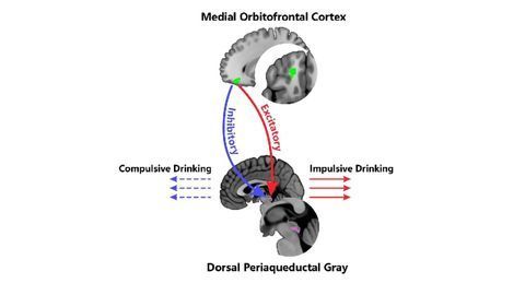 Identified: The Neural Roots of Alcoholism