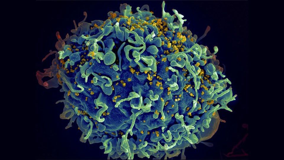 HIV Infection: Restoring the Effectiveness of Immune Cells content piece image