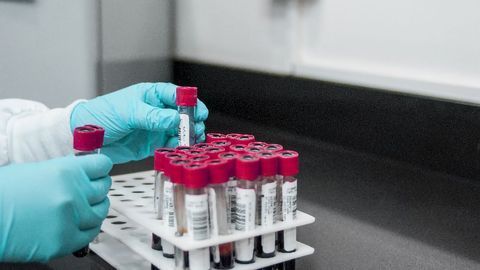 Researchers Advance Simple and Inexpensive Diagnostic Blood Test