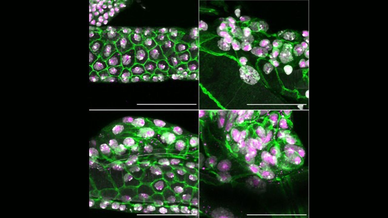 Tumor Suppressor Gene Plays an Essential Role in Development and Tissue Regeneration in Fruit Flies