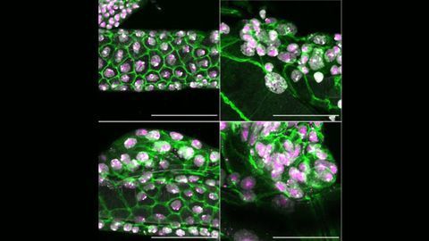 Tumor Suppressor Gene Plays an Essential Role in Development and Tissue Regeneration in Fruit Flies