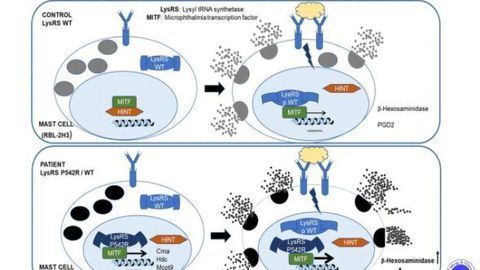 New Molecular Mechanism Identified in Severe Anaphylaxis