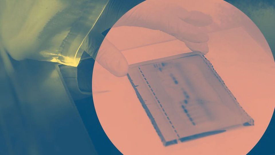 A gloved hand positions a gel on a screen.
