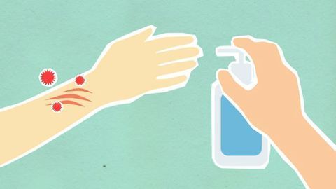 Injecting Hydrogen Peroxide Into Tumors To Improve Radiotherapy