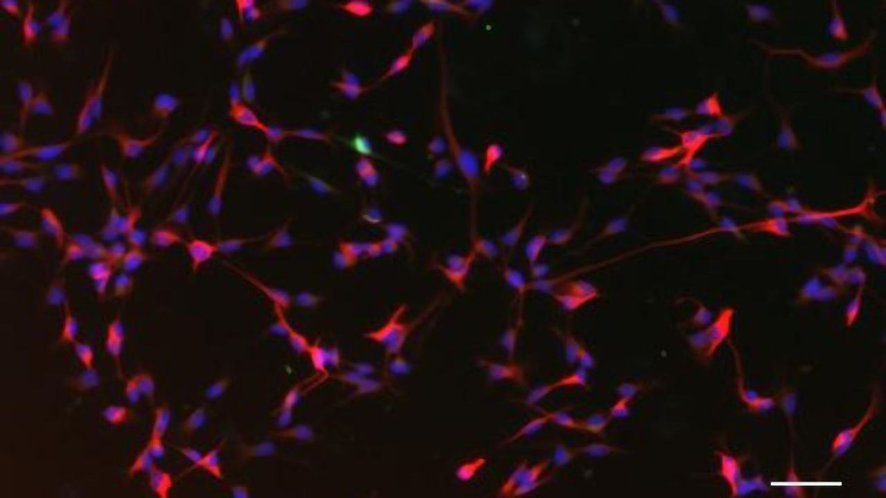 Apple Compounds May Boost Brain Function