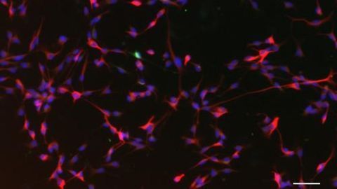 Apple Compounds May Boost Brain Function
