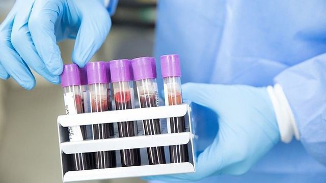 Liquid Biopsy Helps To Assess Effectiveness of Therapy for Colorectal Cancer content piece image 