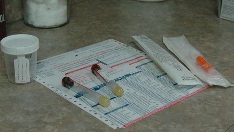 Analyzing Cell-Free DNA in Urine To Detect Cancer