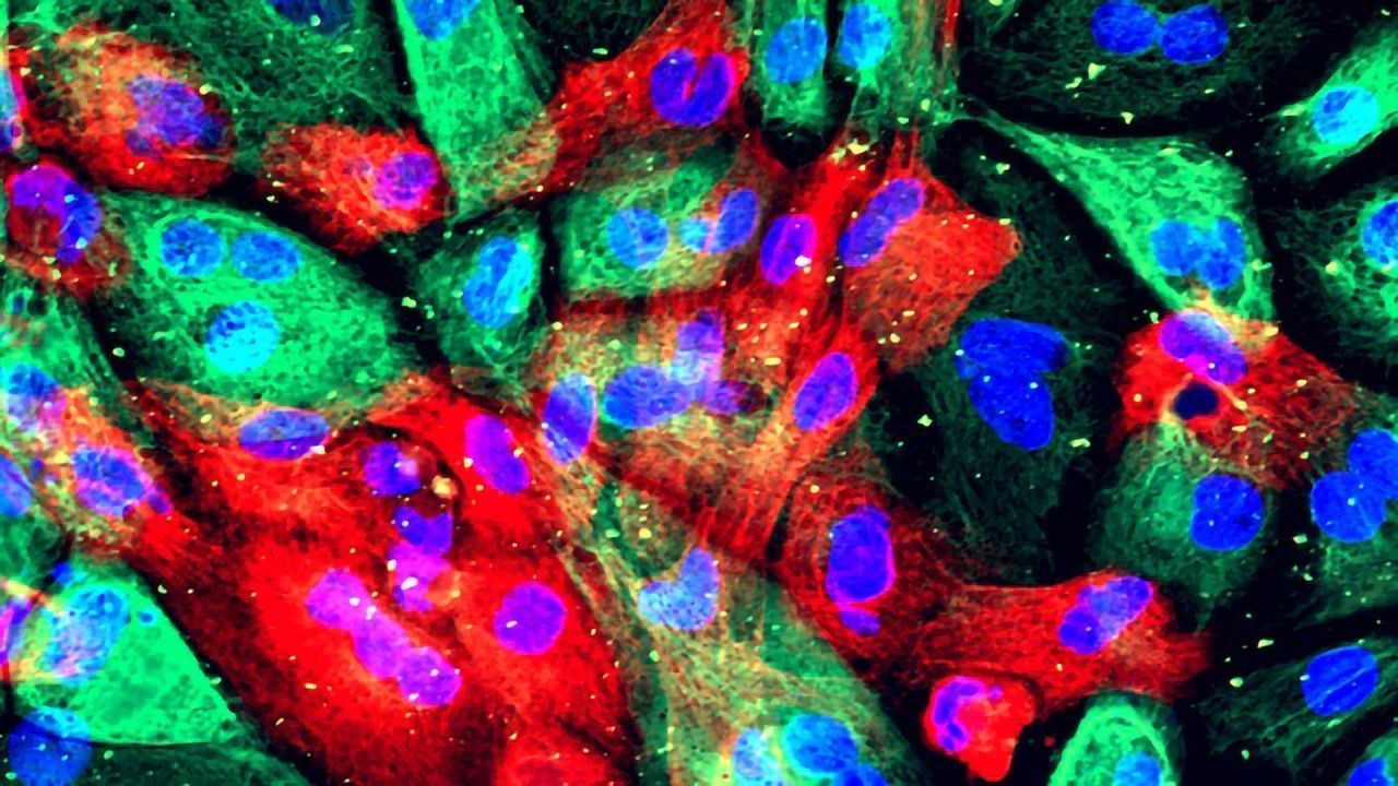 Investigating Biological Differences in Prostate Cancer Across Ethnicities