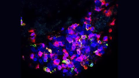 What Can Zebrafish Tell Us About Cancer–Immune System Interactions?