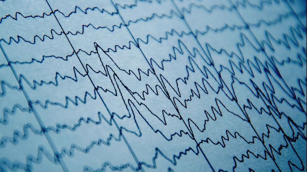 Finding Order in the Chaos of Mass Neuronal Firing