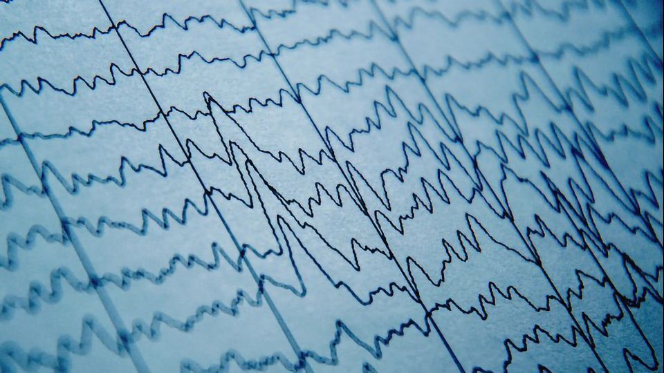 Finding Order in the Chaos of Mass Neuronal Firing content piece image