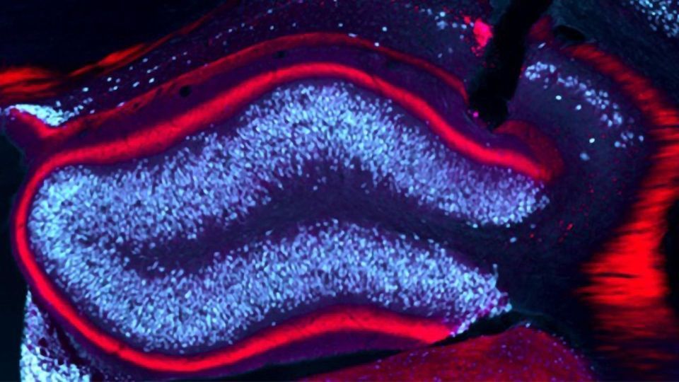 Deep Brain Stimulation Puts a Stop to Epileptic Activity content piece image