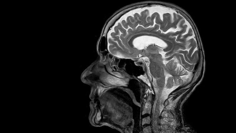 Stroke of Luck: Therapeutic Target Discovered in Blood–Brain Barrier content piece image