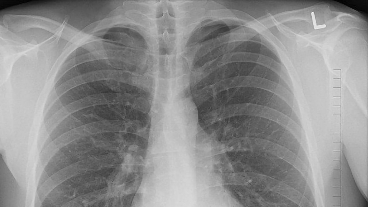 TB Bacteria Use Past Experiences To Guide Their Actions