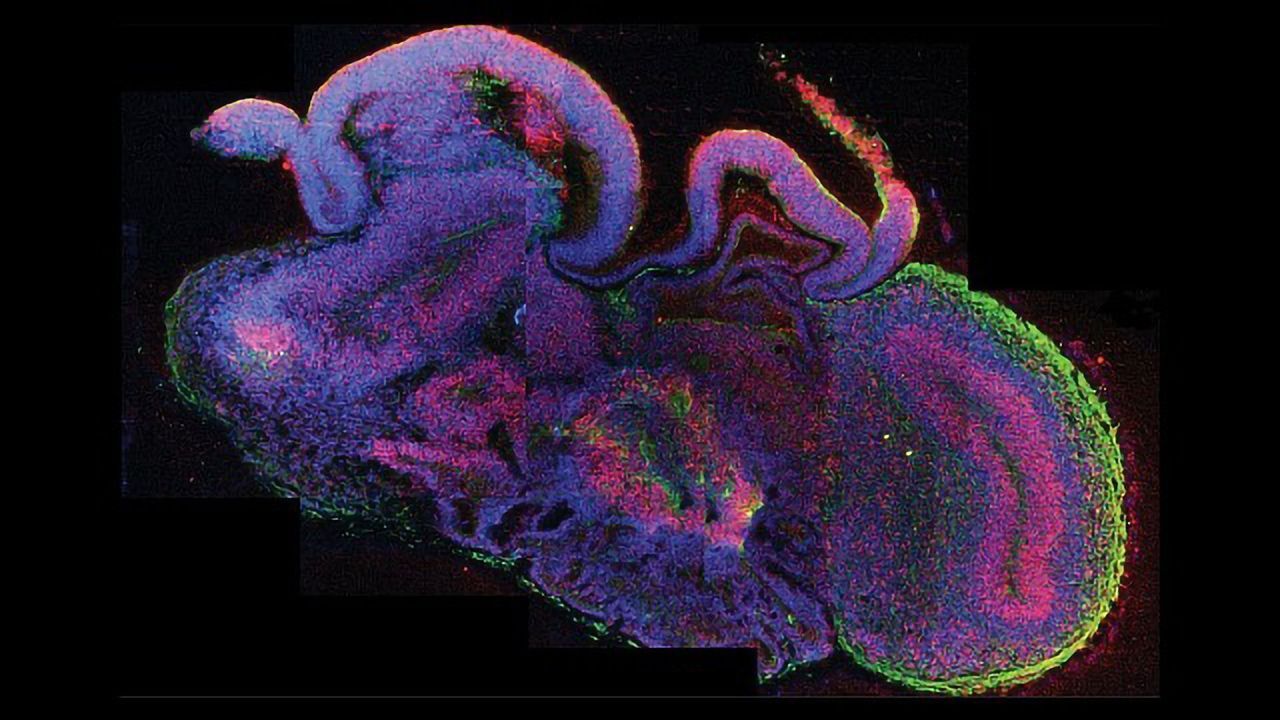 Lab-Grown Brain Organoids Mature Like Infant Brains