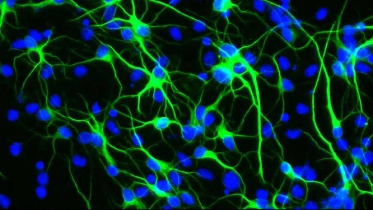 How a Longevity Gene Protects Brain Stem Cells From Stress