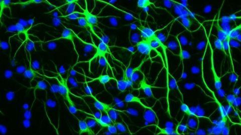 How a Longevity Gene Protects Brain Stem Cells From Stress