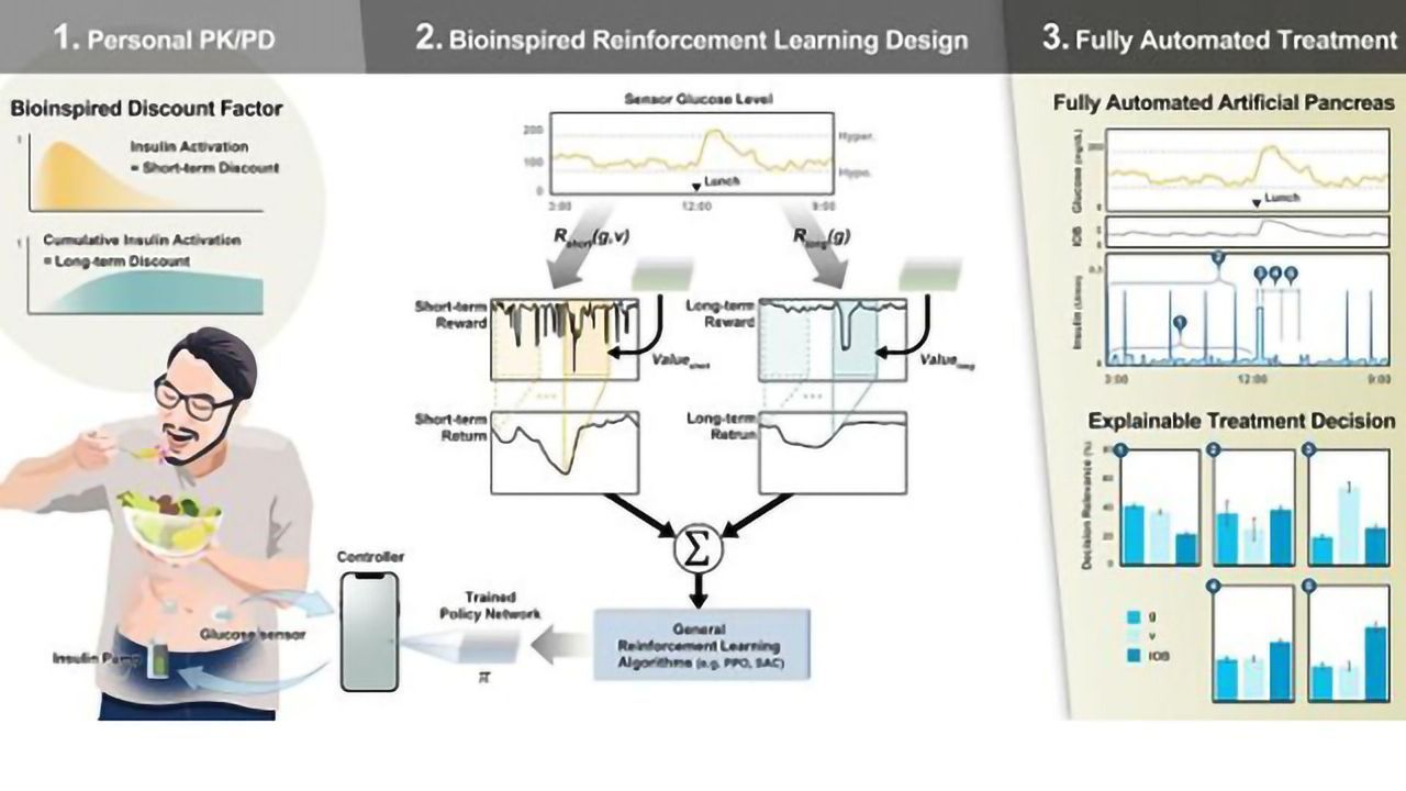 Artificial Pancreas Upgraded With AI Algorithm